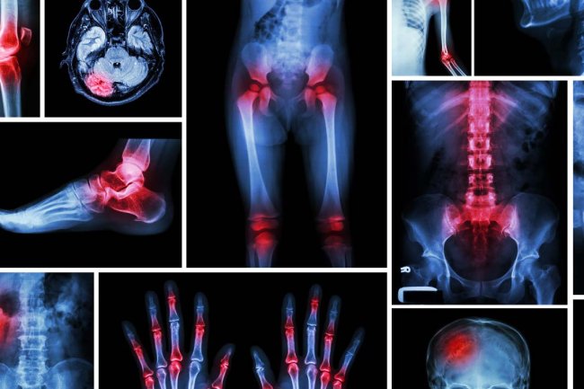 Bangalore's Best Orthopedic Care : Minchu HealthCare - Your Path to Recovery