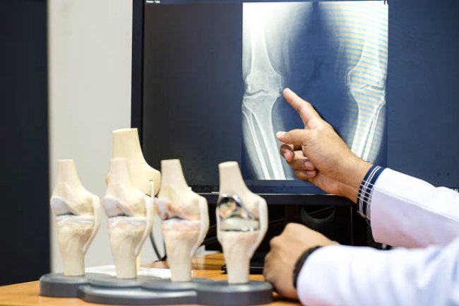 How to Choose the Right Orthopedic Specialist for Your Needs