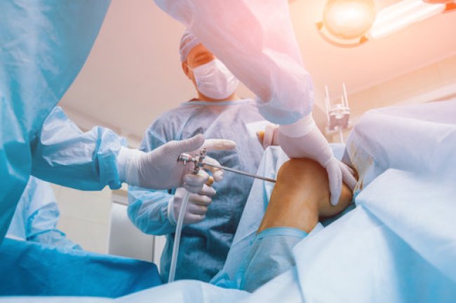 Knee Surgery: What to Expect Before, During, and After