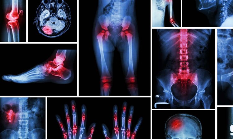 Bangalore's Best Orthopedic Care : Minchu HealthCare - Your Path to Recovery