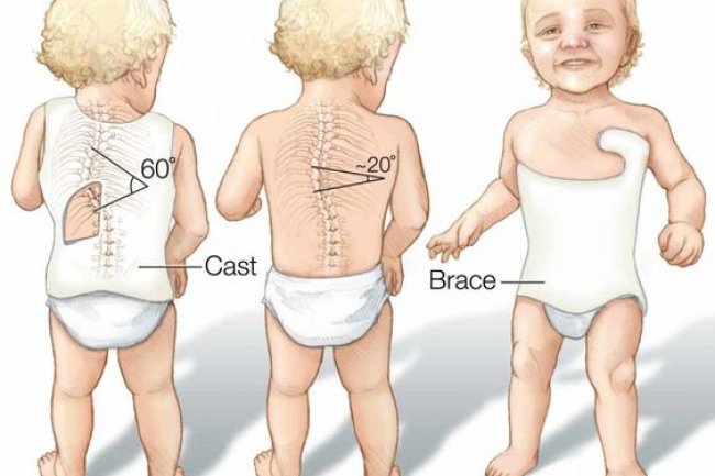 Minchu Health Care: Expert Orthopedic Care for All Ages, From Kids to Adults