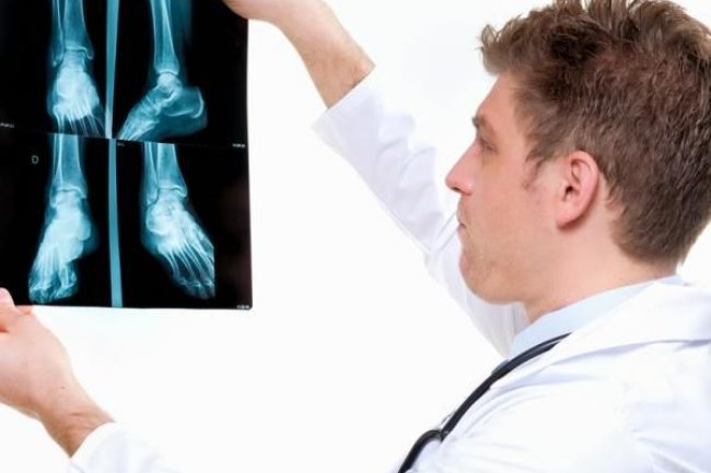 Minchu Health Care: The Best Orthopedic Experts in Bangalore for Your Complete Recovery