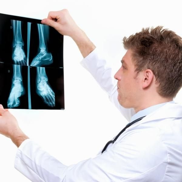 Minchu Health Care: The Best Orthopedic Experts in Bangalore for Your Complete Recovery