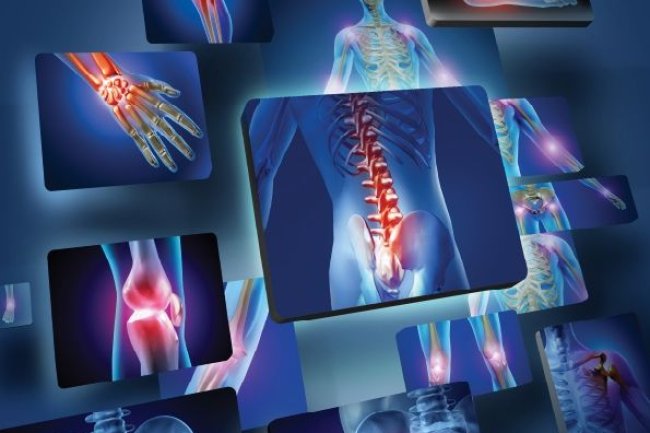 Minchu Health Care: The Best Orthopedic Specialists in HSR Layout, Bangalore – Your Path to Pain-Free Living
