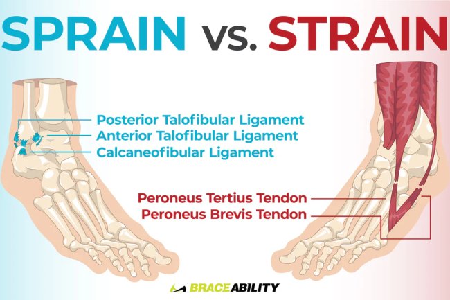 Is It Just a Sprain or a Serious Injury? When to See an Orthopaedic Doctor