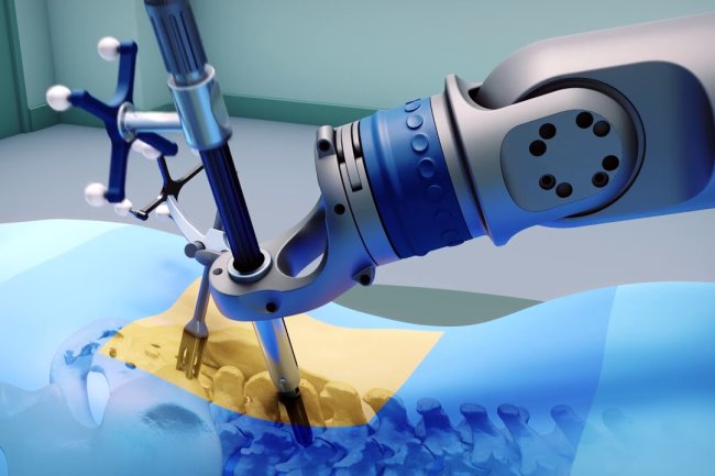 Robotic-Assisted Orthopaedic Surgery: A New Era of Precision and Recovery