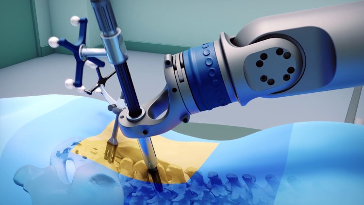 Robotic-Assisted Orthopaedic Surgery: A New Era of Precision and Recovery
