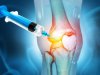 How PRP Therapy Revolutionizes Orthopaedic Healing