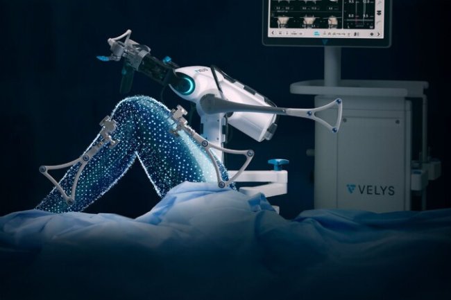 Robotic & AI-Assisted Joint Replacement: The Future of Orthopedic Surgery