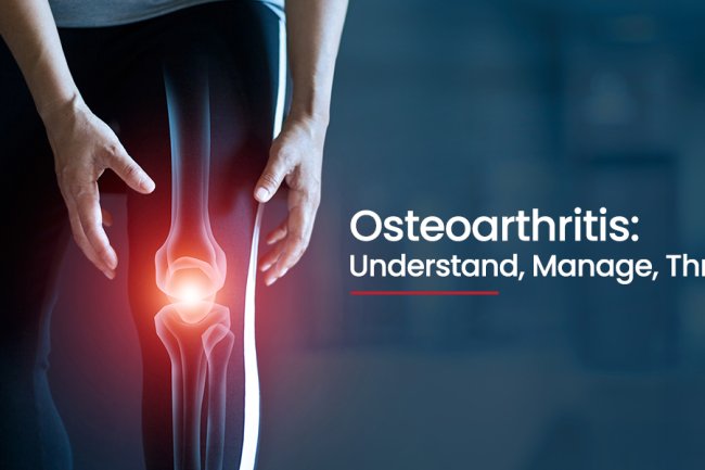 Why Urban Lifestyles are Triggering Early Knee & Hip Arthritis