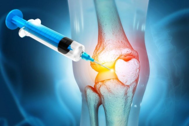 How PRP Therapy Revolutionizes Orthopaedic Healing