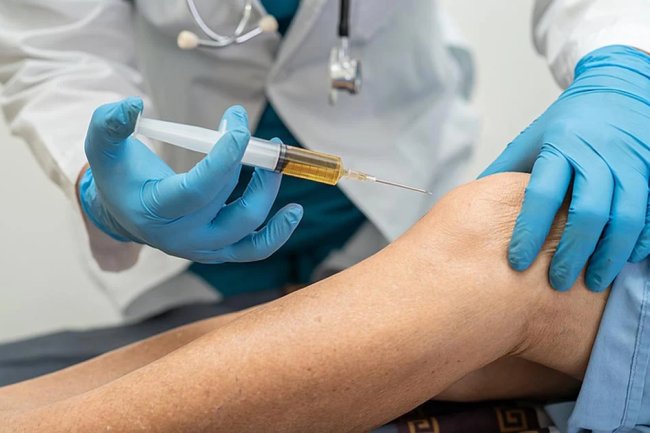 How PRP Therapy Helps You Avoid Surgery and Heal Naturally