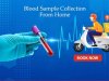 Home Blood Collection in Bangalore: Convenient, Safe, and Accurate Testing at Your Doorstep