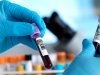 Best Blood Test Packages and Home Testing Benefits in Bangalore
