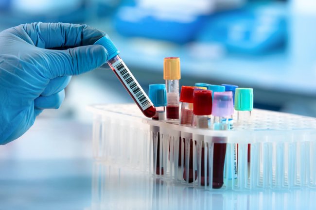 Why Regular Blood Tests Are Essential for Good Health
