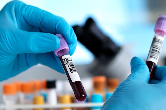 Best Blood Test Packages and Home Testing Benefits in Bangalore