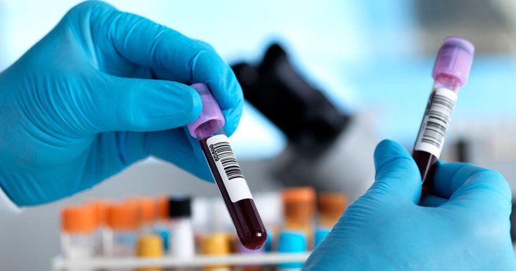 Best Blood Test Packages and Home Testing Benefits in Bangalore